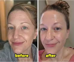 Dr Melaxin™ Eyephalt eyebag cream