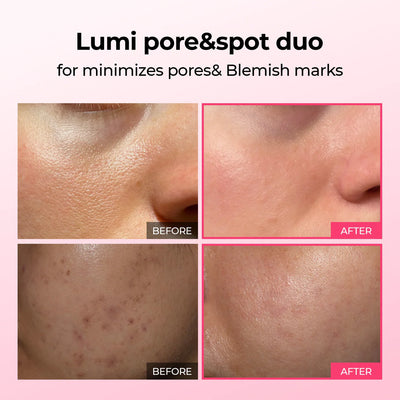 Dr.Melaxin Lumi Pore & Spot Care Duo